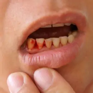gum disease linked to the kidney or overall health
