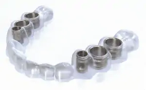 Guided Implant Surgery