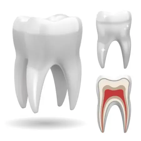 Tooth Whitening