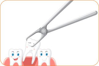 tooth-extraction