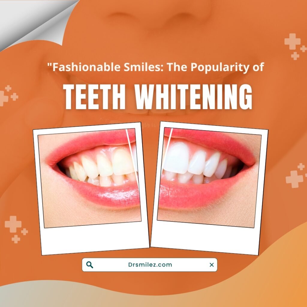 Teeth Whitening